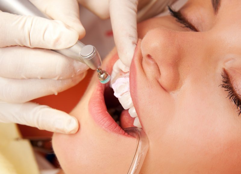 What to Know About Dental Implants in Cranford, NJ