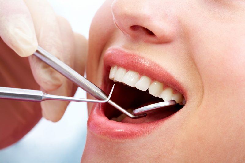 Exploring General Dental Treatment In Midwest City, OK